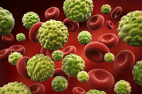 Indo-US experts developing solar-powered oral cancer detector for remote areas