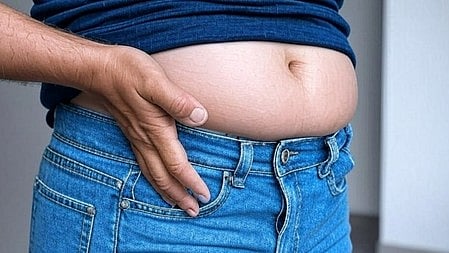 पेट की चर्बी दिखते हुए एक इंसान खड़ा है 