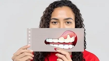 एक लड़की मसूड़ों की जांच करती हुई, मसूड़ों की सूजन और स्वास्थ्य पर ध्यान देती हुई।