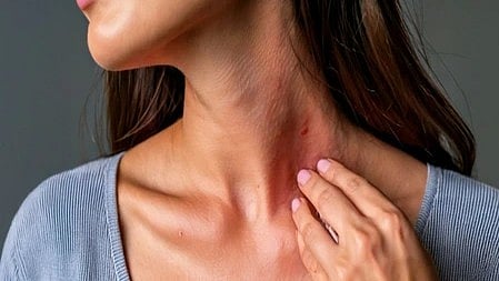 लड़की की त्वचा पर मौसम बदलने से होने वाले लाल चकत्ते और रैशेस|