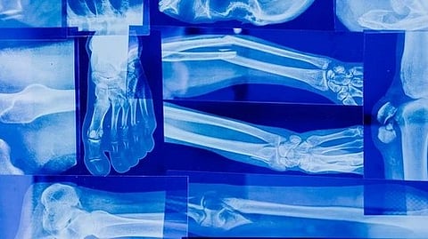 एक्स-रे में दिखाई दे रही मानव हड्डियों की स्पष्ट छवि|