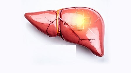 लिवर के लिए जहर समान ज्यादा चीनी, फास्ट फूड और तेल, इन बातों का रखें खास ध्यान