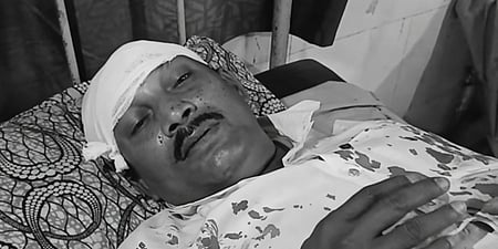 टीएमसी के बदमाशों ने मेरे सिर पर रॉड से वार किया : भाजपा पोलिंग एजेंट