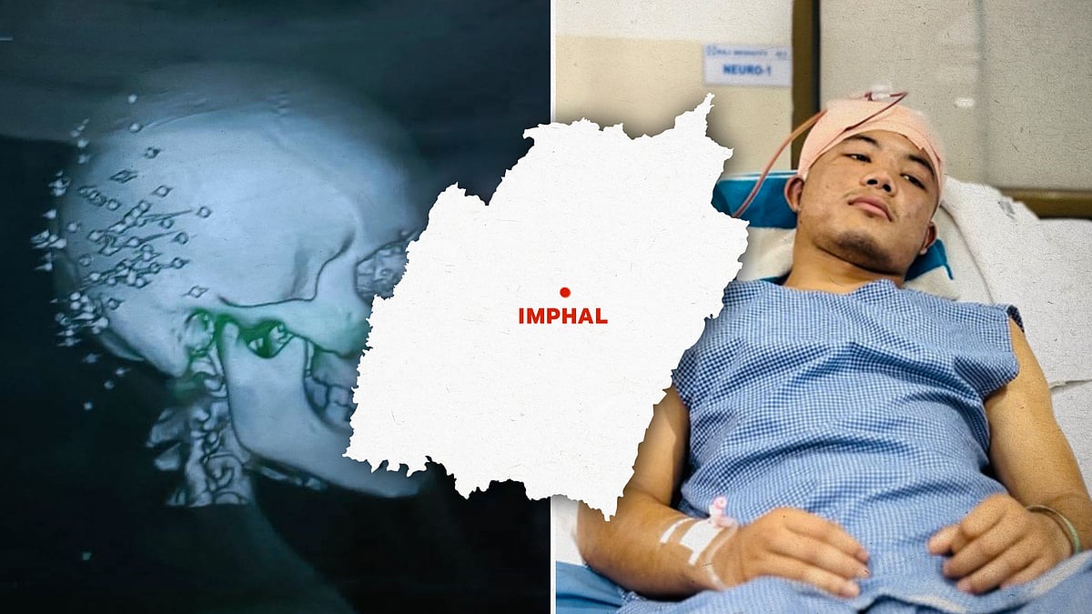 An X-ray showing injuries inflicted on Soaibam Uttam (pictured right).