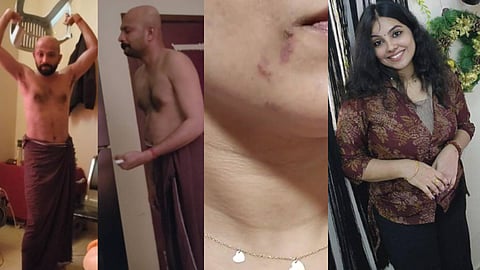 ഭർത്താവ് സതീശ്, മരിച്ച അതുല്യ ശേഖർ