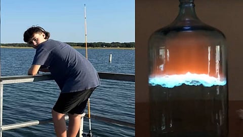 ടിക് ടോക്കിലെ ട്രെന്‍ഡിങ് വീഡിയോ കണ്ട് പരീക്ഷണം; ഗുരുതരമായി പൊള്ളലേറ്റ പന്ത്രണ്ടുകാരന്‍ ചികിത്സയില്‍ 