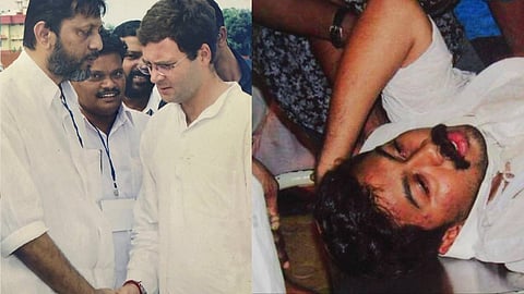 പൊലീസ് ലാത്തി ചാർജില്‍ പരിക്കേറ്റ ആർ. ഇന്ദുചൂഡന്‍