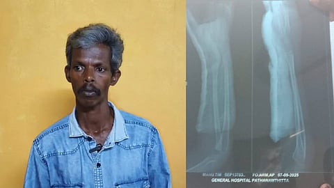 കുട്ടിയുടെ അച്ഛൻ മനോജ് 