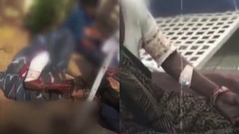 വിശ്വസ്തത തെളിയിക്കാൻ തിളച്ച എണ്ണയിൽ കൈകൾ മുക്കി