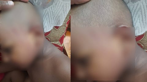 മർദനമേറ്റ കുഞ്ഞ്