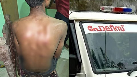 മർദനമറ്റ 17കാരൻ