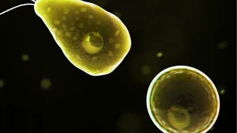 amoebic encephalitis