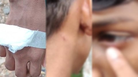 പാലക്കാട് 14കാരനെ വനിതാ പോലീസ് ഉദ്യോഗസ്ഥ മർദിച്ചെന്ന് പരാതി; കേസെടുത്ത് ഷൊർണൂർ പൊലീസ് 