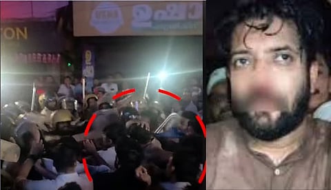 ഷാഫി പറമ്പിലിന് മർദനമേൽക്കുന്ന ദൃശ്യങ്ങൾ