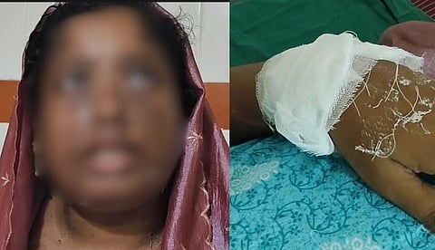 ഉസ്താദ് നിര്‍ദേശിച്ച ആഭിചാര ക്രിയയ്ക്ക് കൂട്ടുനിന്നില്ല; കൊല്ലത്ത് യുവതിയുടെ മുഖത്ത് തിളച്ച മീന്‍കറി ഒഴിച്ച് പൊള്ളിച്ച് ഭര്‍ത്താവ്