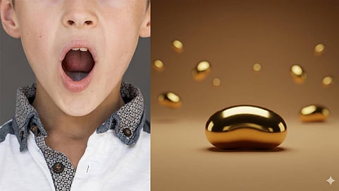 1,24,832 രൂപയുടെ സ്വര്‍ണം അബദ്ധത്തില്‍ വിഴുങ്ങി പതിനൊന്നുകാരന്‍; മകനെ വീട്ടില്‍ നിന്നും പുറത്തുവിടാതെ അമ്മ  