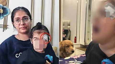 മേശയുടെ കോര്‍ണറില്‍ ഇടിച്ച് തലമുറിഞ്ഞു; കുട്ടിയുടെ മുറിവ് ഫെവിക്വിക് ഉപയോ​ഗിച്ച് ഒട്ടിച്ച് ഡോക്ടർ