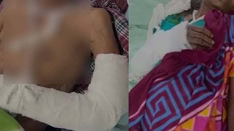 "പറമ്പിൽ കോഴി കയറി", വയനാട്ടിൽ വൃദ്ധ ദമ്പതികൾക്ക് അയൽവാസിയുടെ ക്രൂരമർദനം; കൈകൾ തല്ലിയൊടിച്ചു