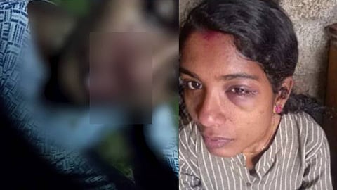 മർദനമേറ്റ കുട്ടിയും അമ്മയും