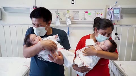 മൂന്ന് മണിക്കൂറിലധികം നീണ്ട അതിസങ്കീർണ ശസ്ത്രക്രിയ;  പെറുവില്‍ നട്ടെല്ലിൻ്റെ ഭാഗം ഒട്ടിച്ചേർന്ന സയാമീസ് ഇരട്ടകളെ വിജയകരമായി വേർപെടുത്തി