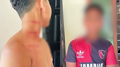 മർദനമേറ്റ കുട്ടി