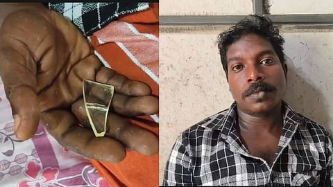 കാലിൽ തറച്ച ചില്ലു നീക്കാതെ മുറിവ് തുന്നിക്കെട്ടി, യുവാവ് വേദന സഹിച്ചത് അഞ്ചു മാസം; വണ്ടാനം മെഡിക്കല്‍ കോളേജിനെതിരെ ചികിത്സ പിഴവ് ആരോപണം