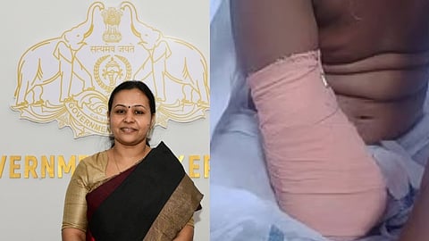 പാലക്കാട്  ജില്ലാ ആശുപത്രിയിലെ ചികിത്സാ പിഴവ്; വിനോദിനിക്ക് കൃത്രിമ കൈ വയ്ക്കാൻ സഹായം നൽകുമെന്ന് ആരോഗ്യമന്ത്രി   