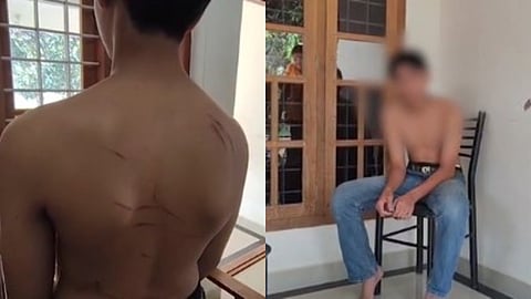 boy Attacked by students Wayanad