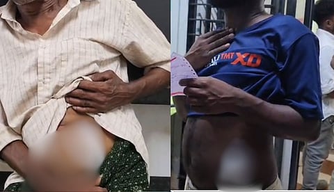 ഉത്സവത്തിനിടെ തര്‍ക്കം: കോമരത്തിന്റെ വാളുപയോഗിച്ച് വെട്ടി; മൂന്ന് പേര്‍ ആശുപത്രിയില്‍