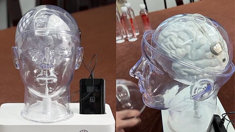 ഇൻവേസീവ് ബ്രെയിൻ-കമ്പ്യൂട്ടർ ഇൻ്റർഫേസ് 