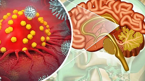 
Be vigilant against amoebic encephalitis

