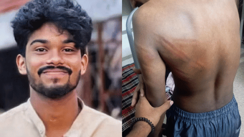 ആദിത്യൻ / മർദനമേറ്റ വിദ്യാർഥിയുടെ ദൃശ്യം