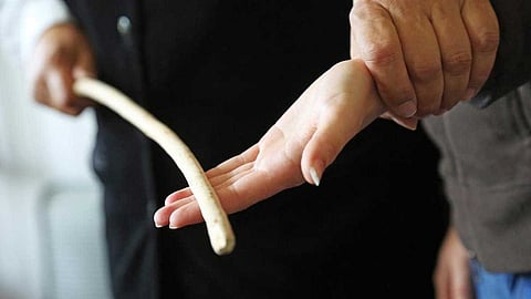 സീറ്റ് മാറിയിരുന്നതിന് ഒമ്പതാം ക്ലാസുകാരനെ അധ്യാപകൻ ക്രൂരമായി മർദ്ദിച്ചതായി പരാതി