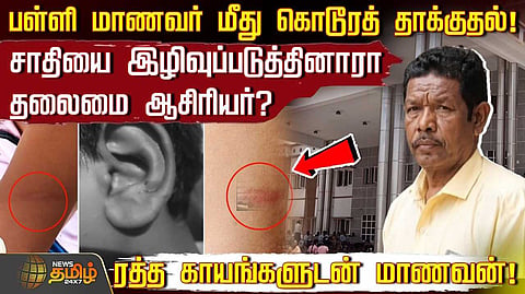 ரத்த காயங்களுடன் சிகிச்சை பெறும் மாணவன்