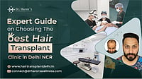 Expert Guide On Choosing The Best Hair Transplant Clinic In Delhi NCR Hair transplant results and clinic in Delhi NCR