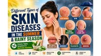 Different Types Of Skin Diseases In The Summer And Rainy Season