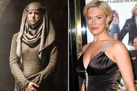 Hannah Waddingham Recalls Teacher's Cruel Jibe About Her Face