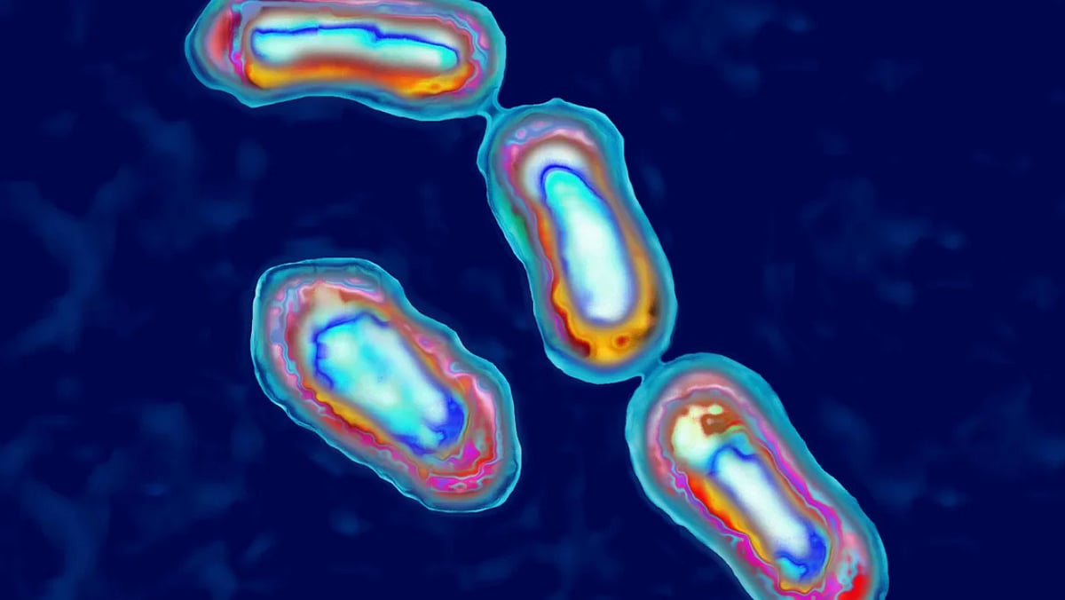 Yersinia pestis bacteria causes bubonic plague in animals and humans - Getty Images