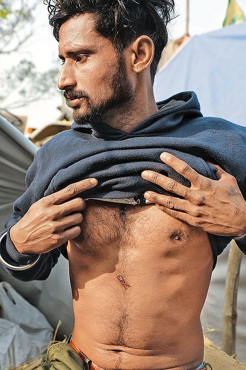 Gur Dev Singh who was hit by a pellet