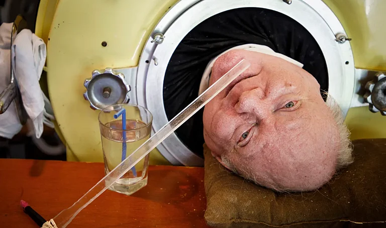 Paul Alexander, The Man In The Iron Lungs - AP