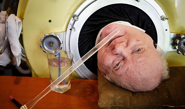 Paul Alexader, 'Man In The Iron Lung' For Over 70 Years Dies At The Age Of 78