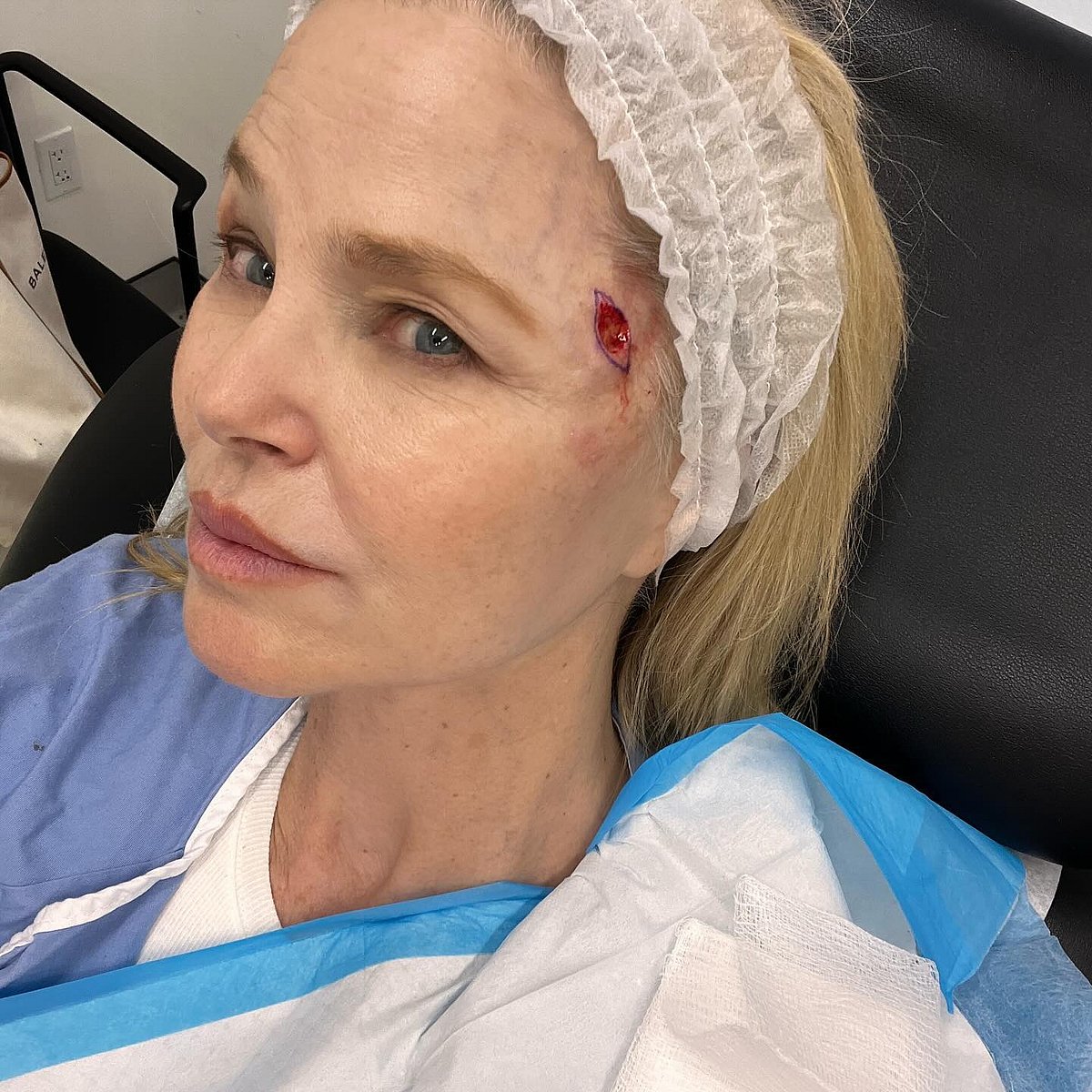 Christie Brinkley Rushed To Hospital After Being Diagnosed With Skin ...