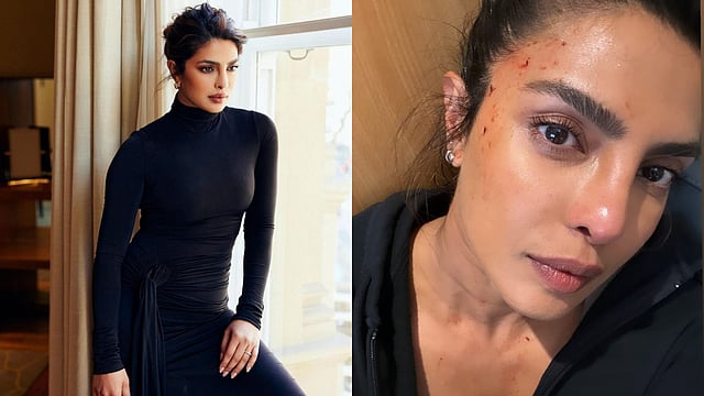 Priyanka Chopra Shares ‘Bloodied Up’ Pic From 'Heads Of State' Sets; Leaves Fans Shocked