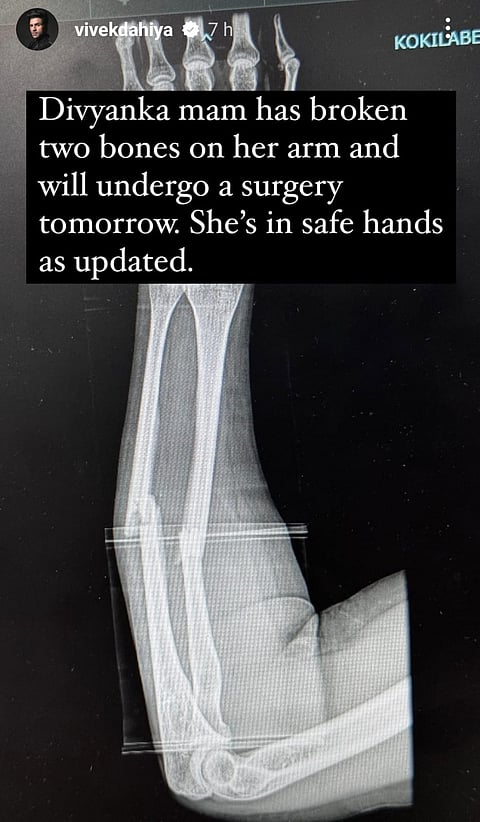 Divyanka Tripathi's X-ray