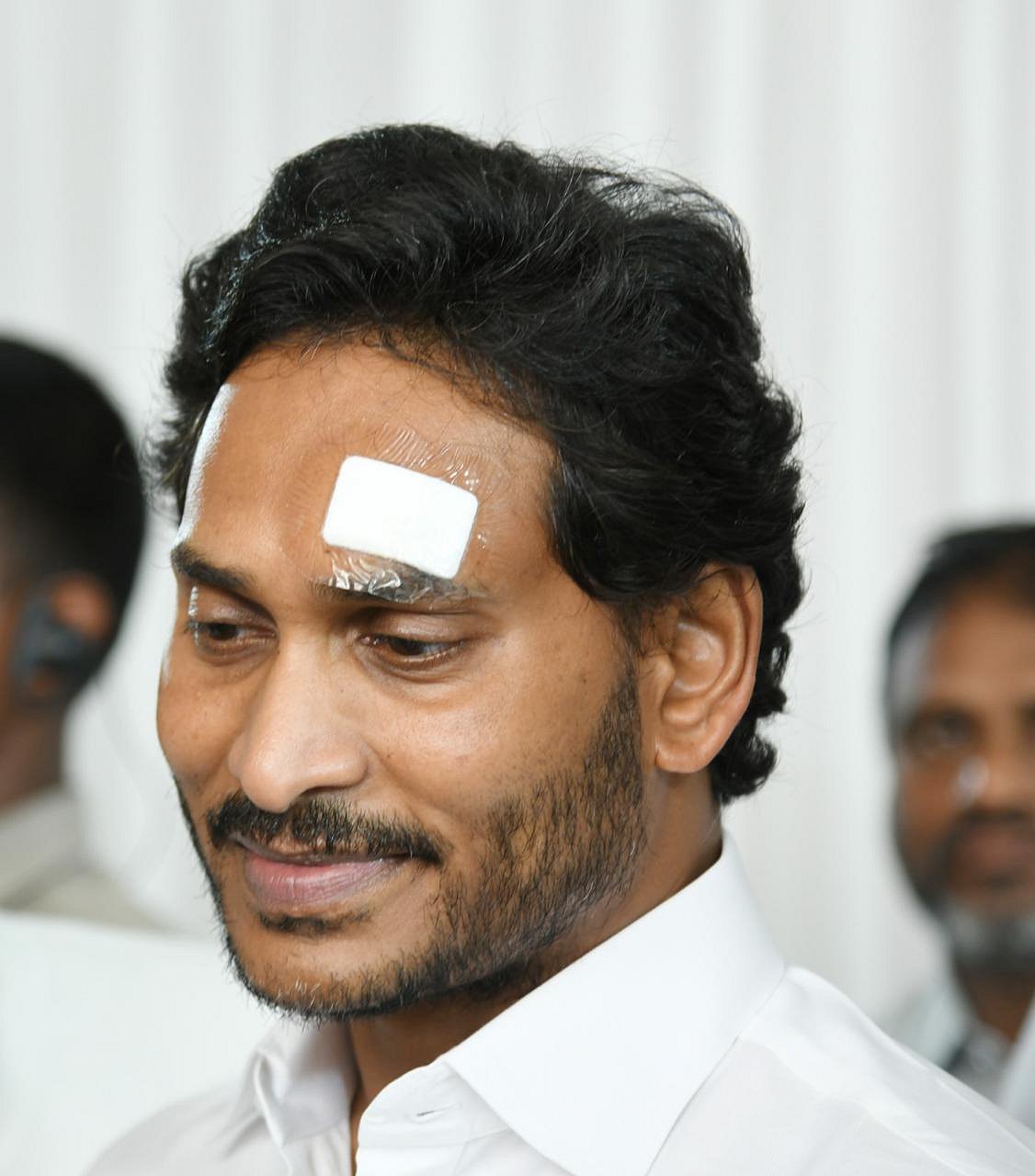 X/@YSRCParty : AP CM injured in pelting of stones during election campaign