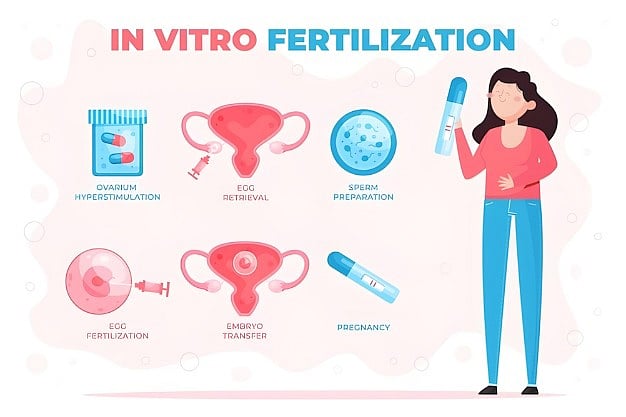 In Vitro Fertilization (IVF)