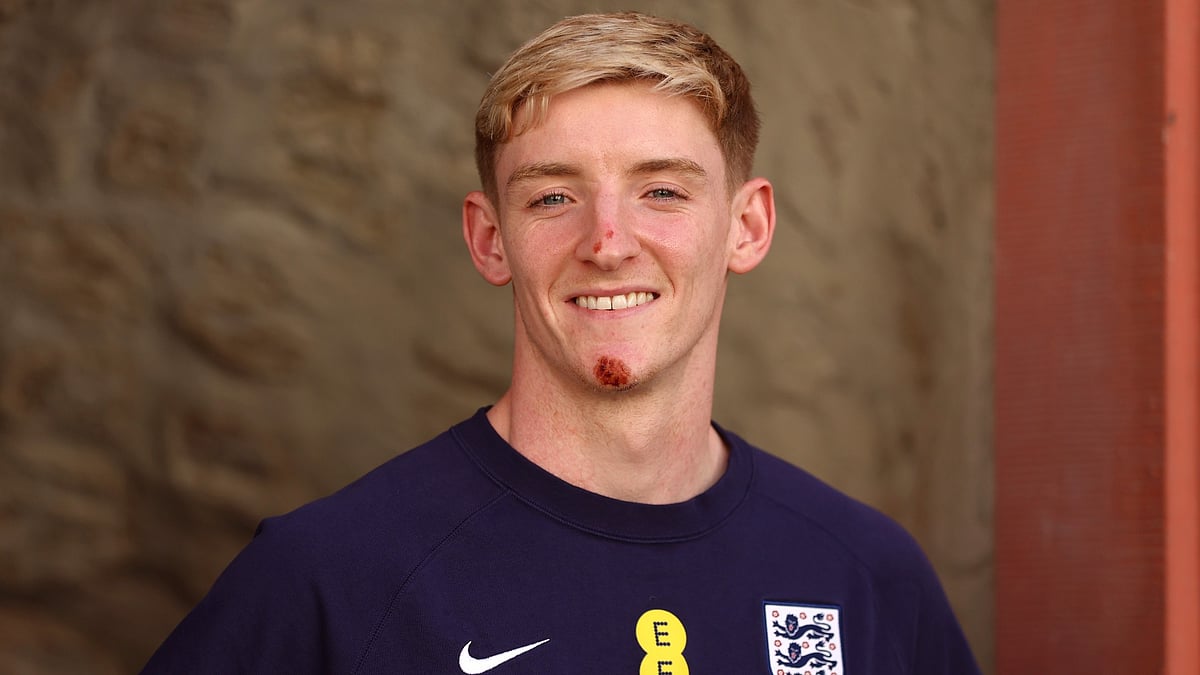 Anthony Gordon took a tumble this week.