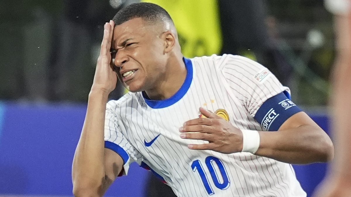 Kylian Mbappe has broken his nose
