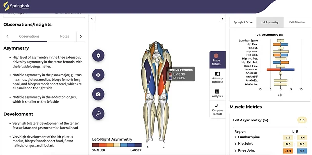 Springbok Analytics: Revolutionizing Athlete Recovery With AI-Powered ...