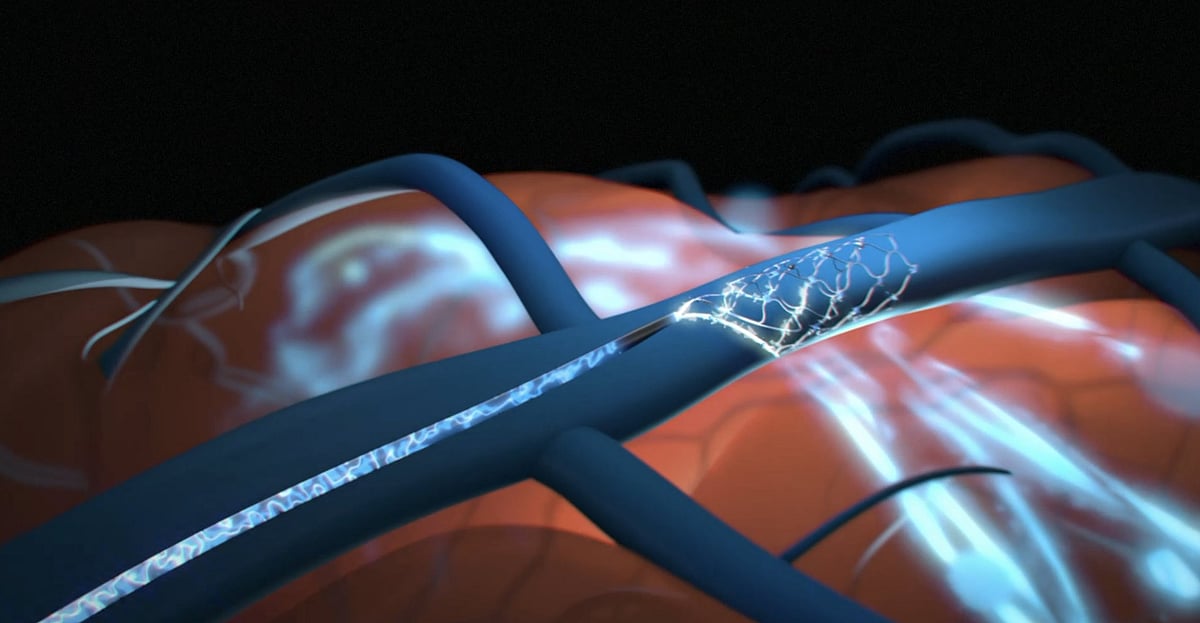 Representative Image - null